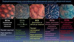 Диагностика колоректальных поражений с помощью новой эндоцитоскопической классификации EC.